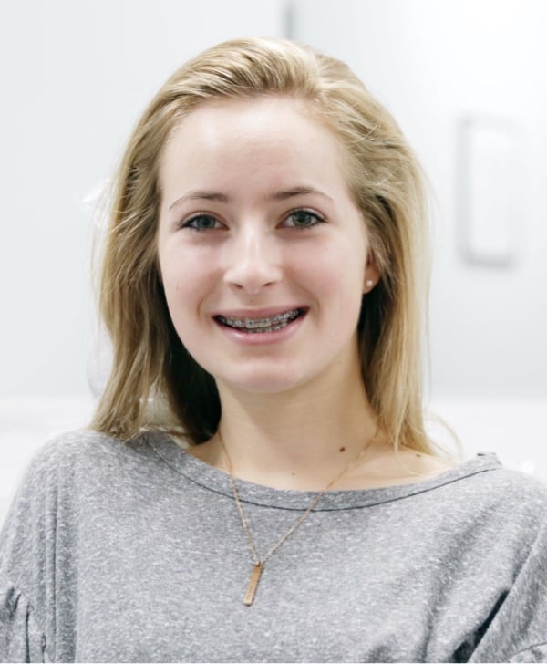 teen patient smiling