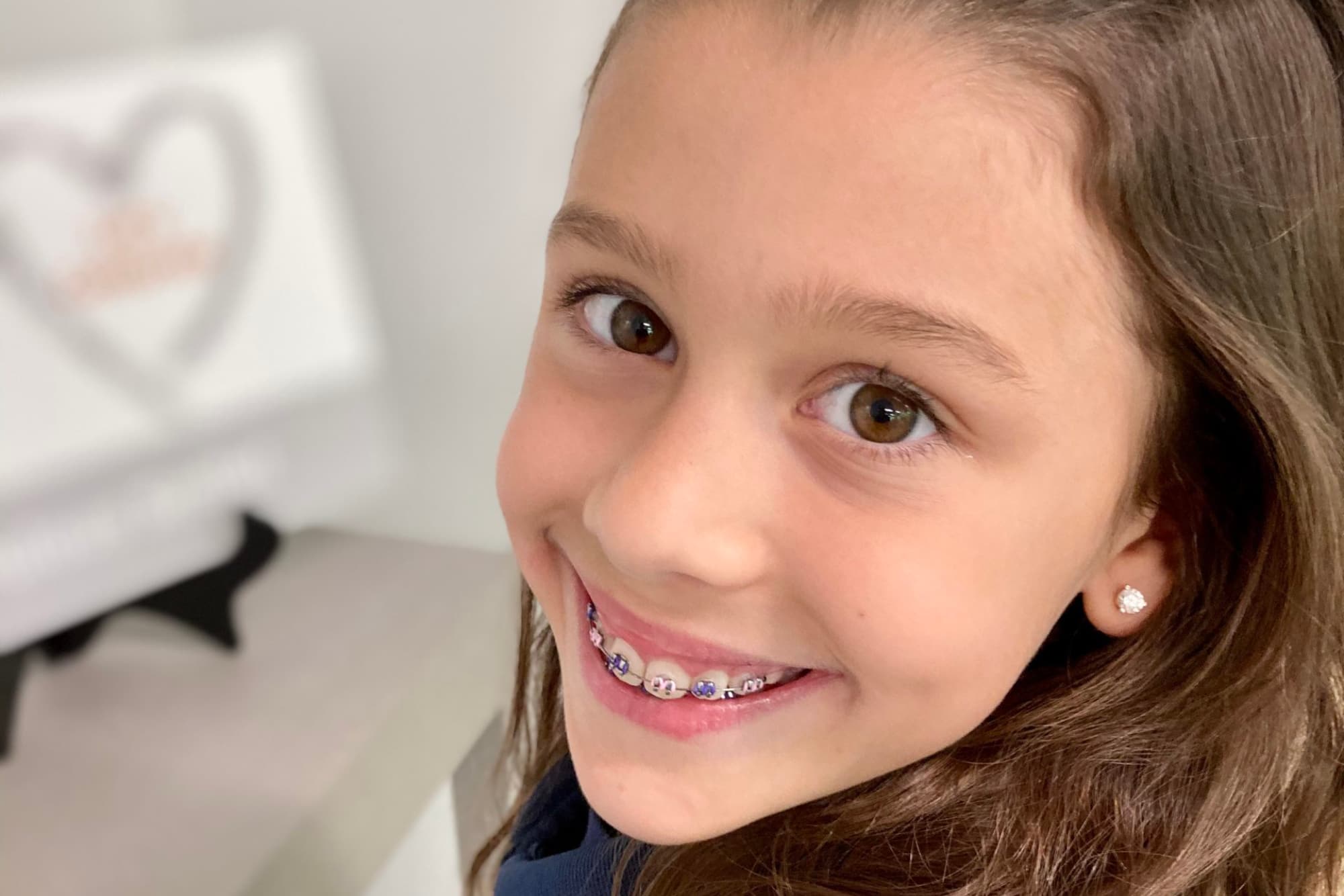 What To Expect When You Get Your Braces Off